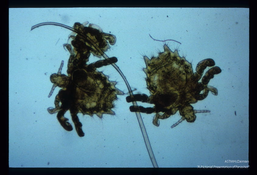 Crab lice have a relatively narrow head, a broad thorax and crab-like claws.