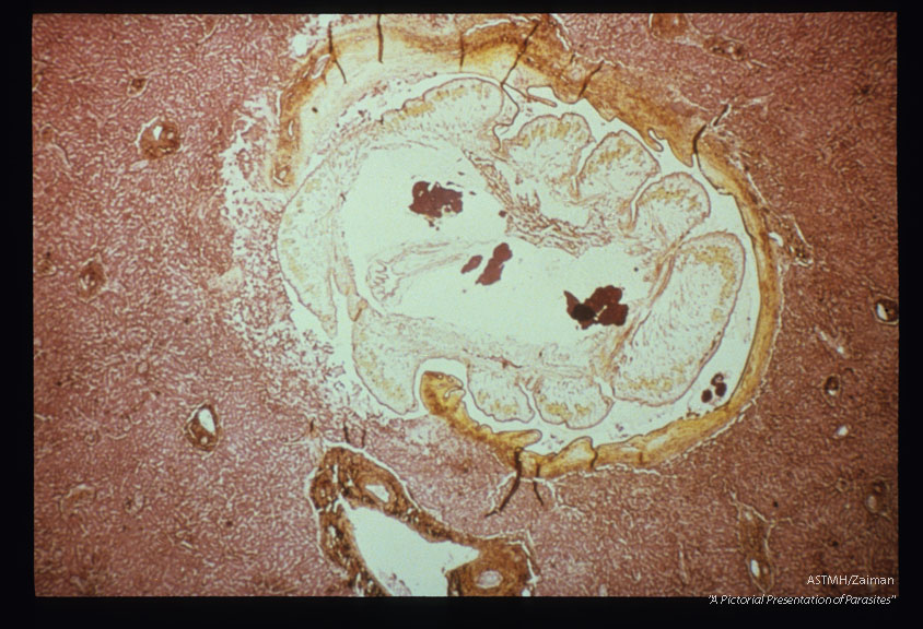 Liver sections at different magnifi­cations.