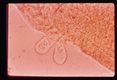Miracidium has just penetrated the snail host leaving behind the two epidermal plates of the last row.