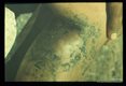 Abscess formation.