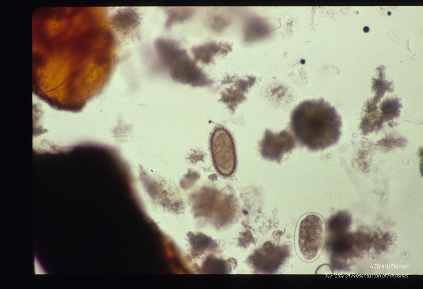 Capillaria and hookworm eggs are present.