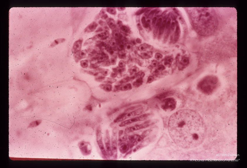 Second-generation schizonts. Note that the second-generation merozoites are about twice as large as those of the first-generation. H & E stain. (96 hr).