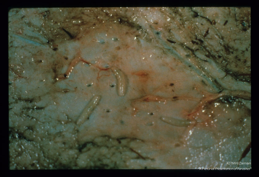 Cutaneous myiasis in bison skin.