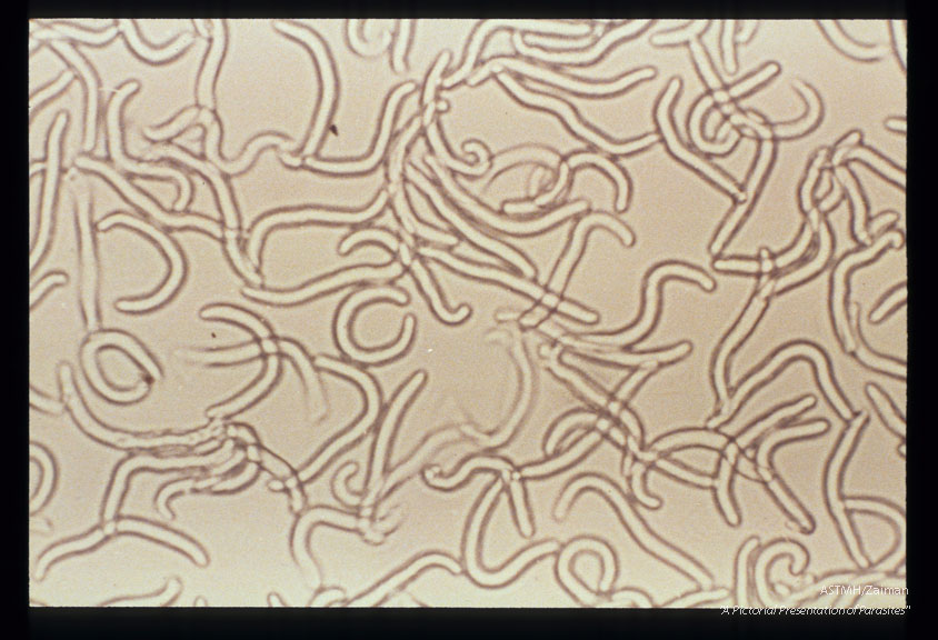 Newborn larvae of Trichinella spiralis.