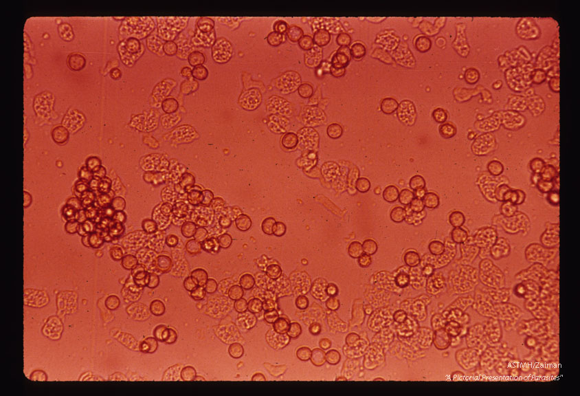 Lee-culture #9 - showing many trophs and cysts, often in clumps.