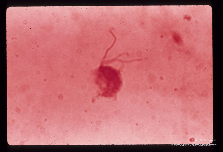 Several flagella and the nucleus are easily seen.