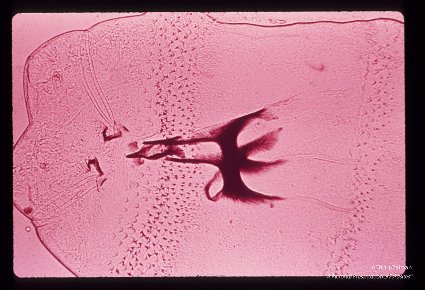 Myiasis. Premature infant died shortly after birth. Numerous first stage larvae were present in the ear. Similar larvae were recovered from the mothers vulva. Efforts to rear maggots were unsuccessful.