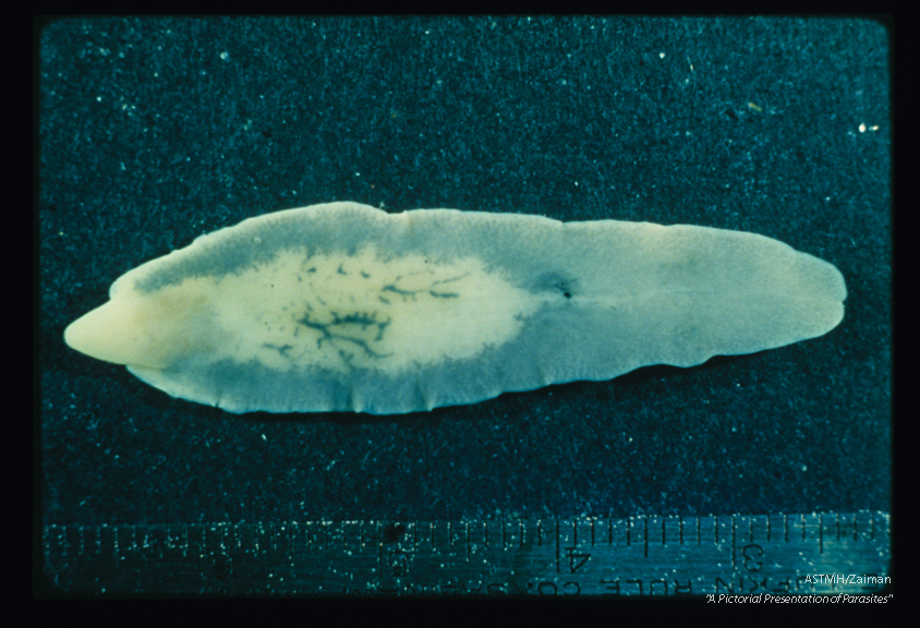 Dorsal view of formalin fixed unstained adult. .