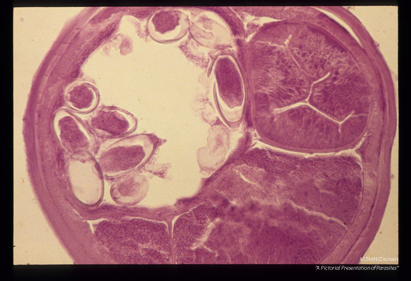 Cross section through an adult with many eggs.