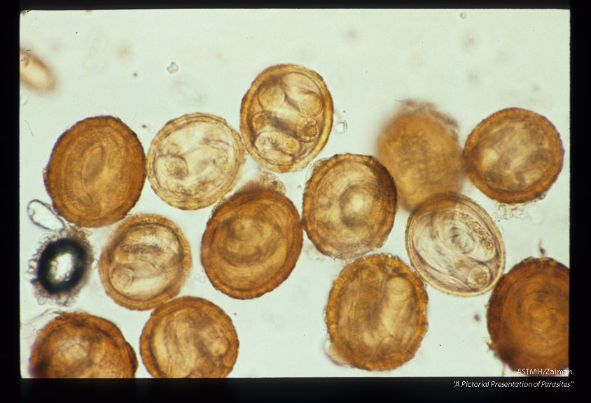 Infective eggs recovered from soil in a rabbit cage which had previously housed raccoons.