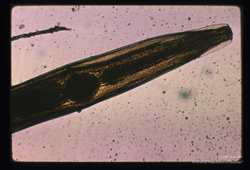 Anterior end of the parasite showing the cervical alae and the bulbous esophagus. (Human appendix. )