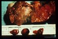 Adult parasites removed from cavity in cat lung.