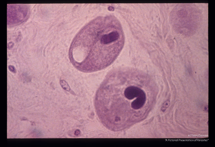 Trophozoites. Note the contractile vacuole and the macroneucleus.