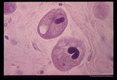 Trophozoites. Note the contractile vacuole and the macroneucleus.