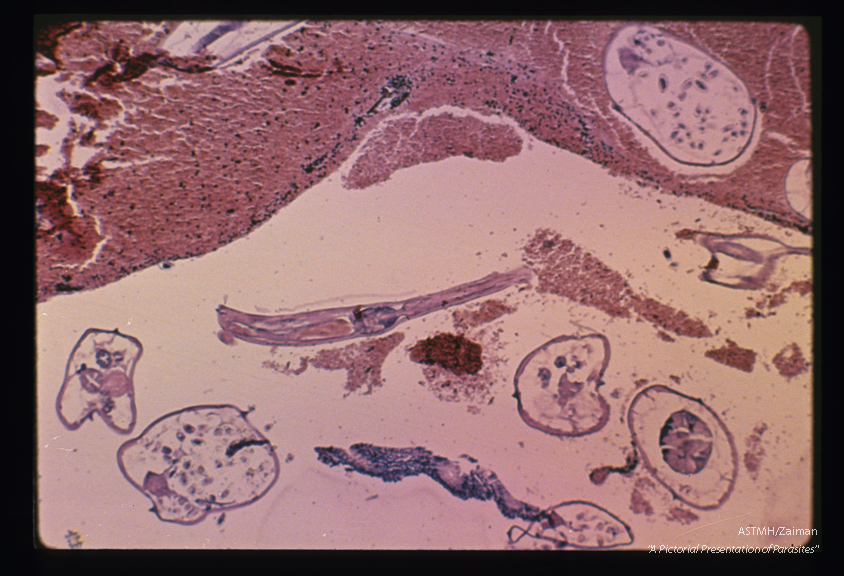 Multiple cross sections show lateral crests, digestive tracts and ova in uteri. This photograph was taken primarily to demonstrate the structure of the esophagus in longitudinal section. Note the free blood present in the appendiceal lumen and in the gut of the parasite.