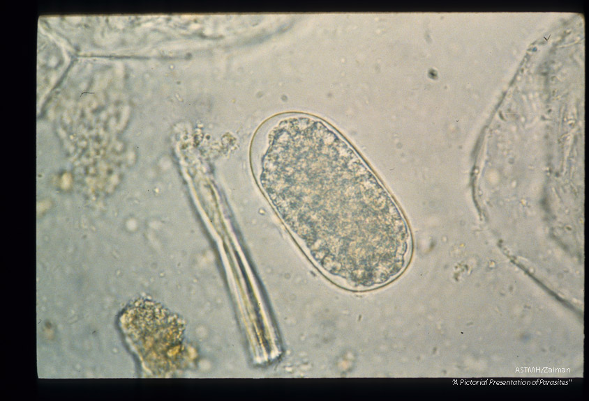 Sequence showing development of larva in egg.