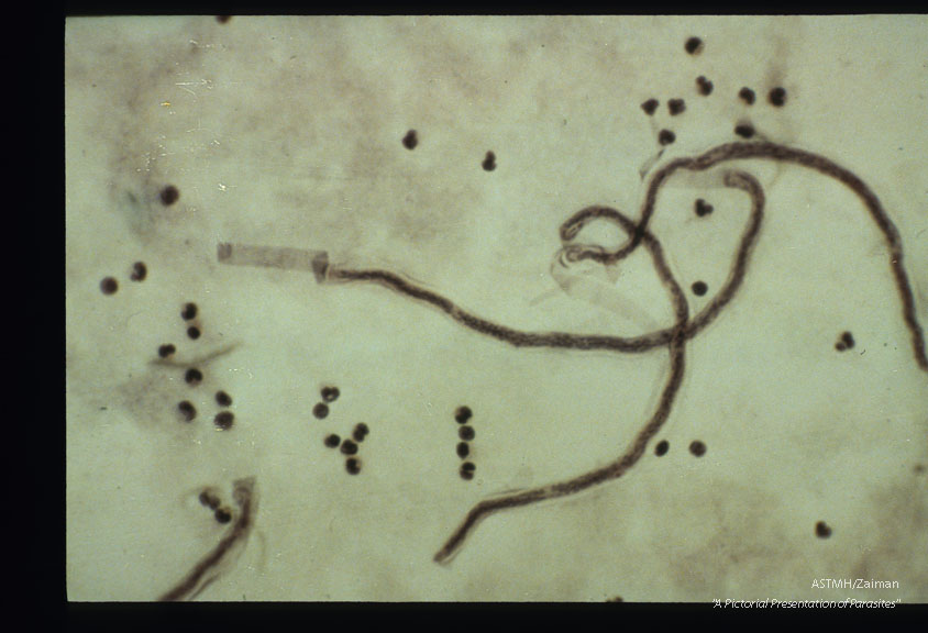 Microfilaria; entire microfilarae.
