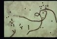 Microfilaria; entire microfilarae.