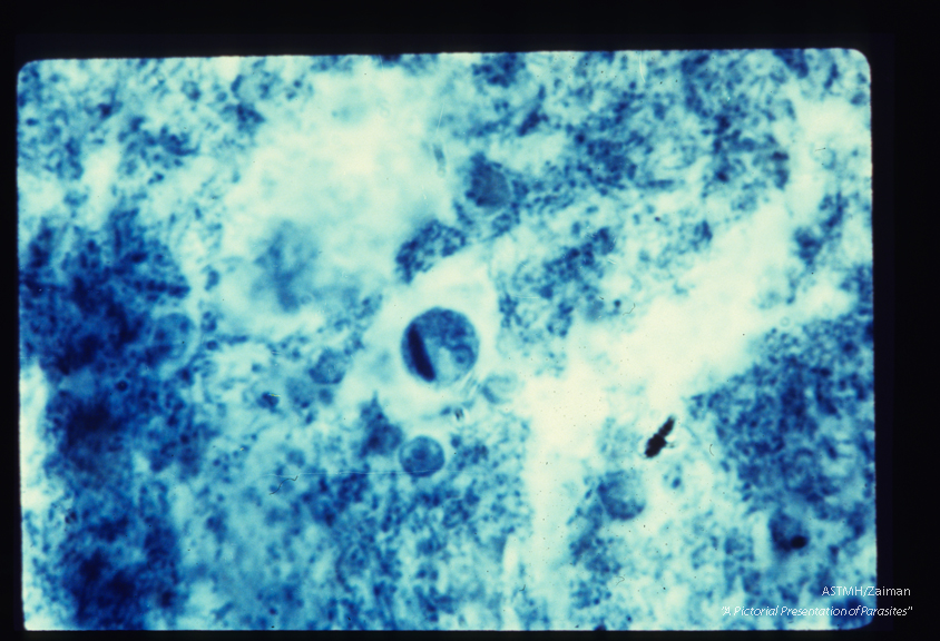 Cyst with at least three nuclei and chromatoidal bar.