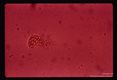 Flagellate (x oil) showing bulges on flagella.