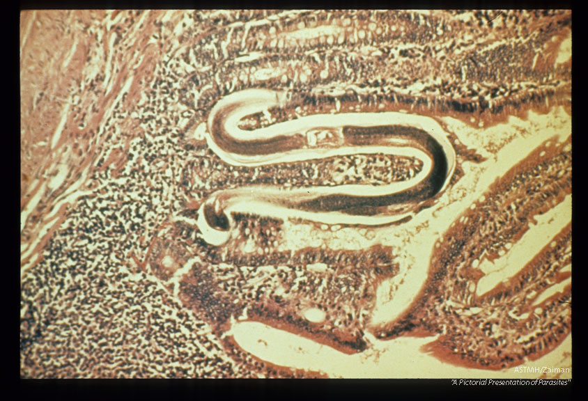 Adult female in duodenal, mucosa of Erythrocebus patas.