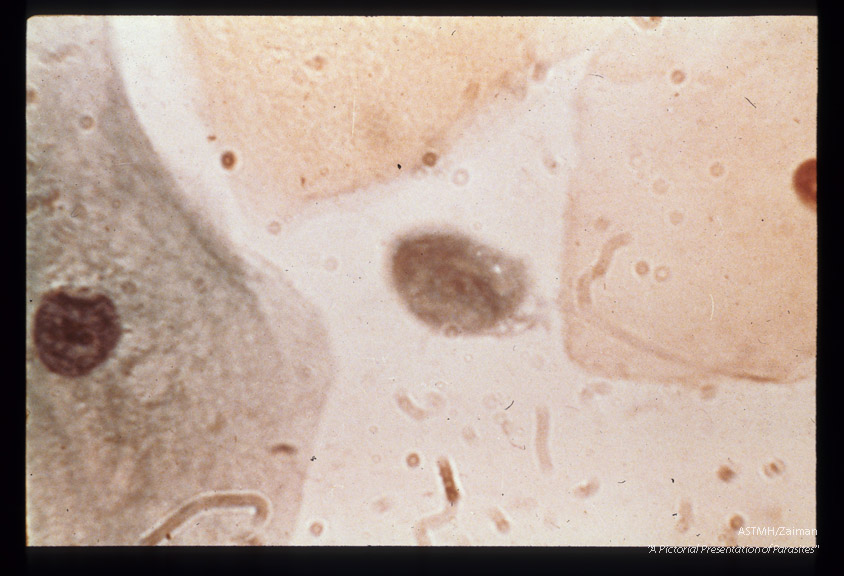 Papanicolaou stain of vaginal smear.