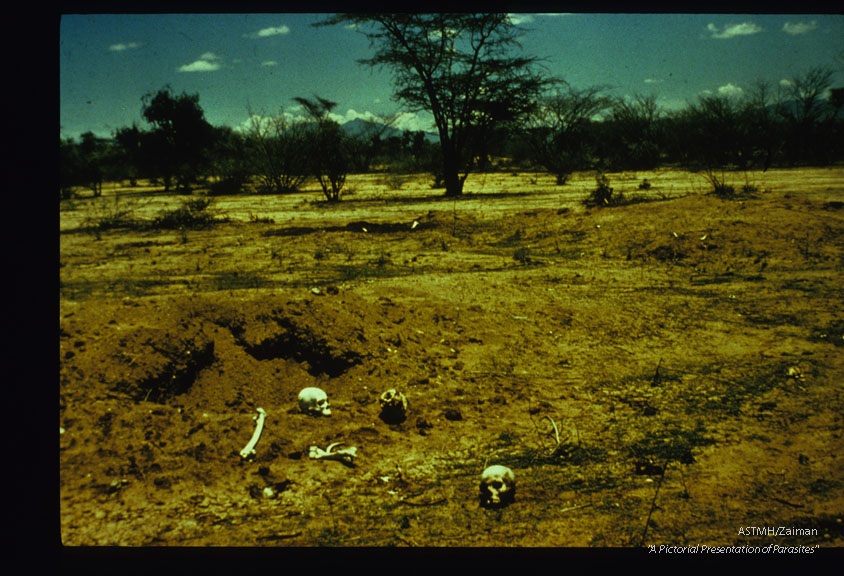 Shallow graves dug up by dogs.