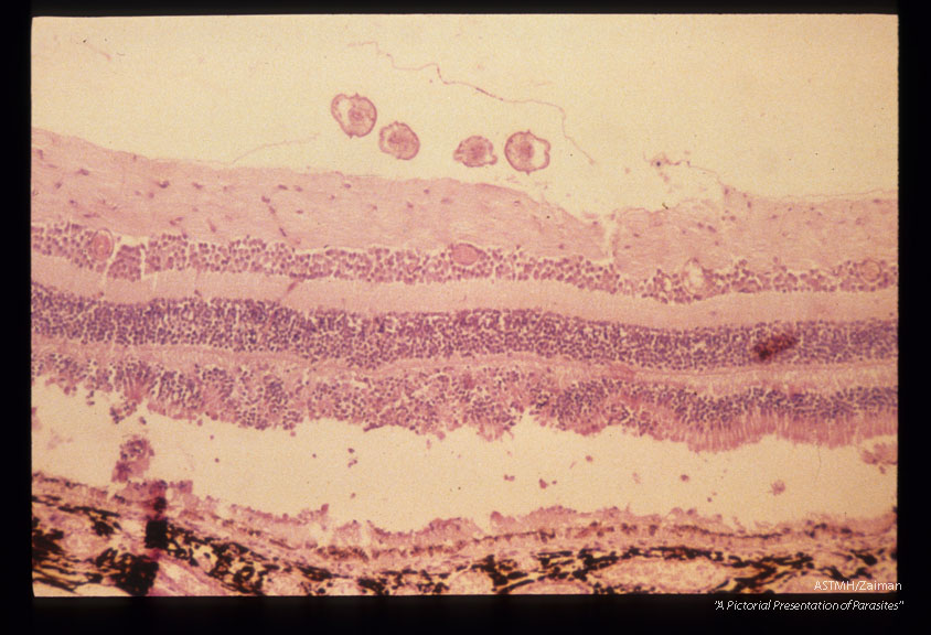 Subretinal disruption and necrosis. Larva under inner limiting membrane in an experimentally infected cynomolgus monkey.
