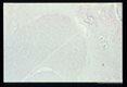 Longitudinal and cross-section of larvae in the spinal cord.