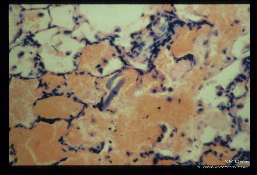 Larvae are present in an area of pulmonary hemorrhage within an experimentally infected Erythrocebus patas.