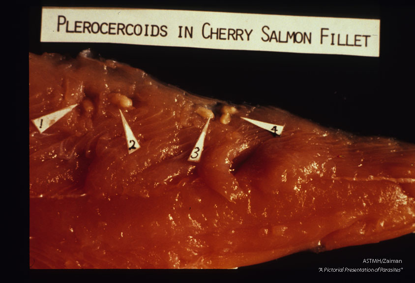 Encysted plerocercoids in cherry salmon fillet.