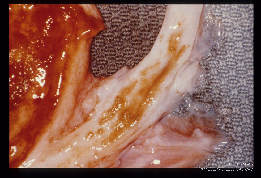 Sandy patches in ureteral mucosa of a chimpanzee. Note inflamed bladder mucosa.