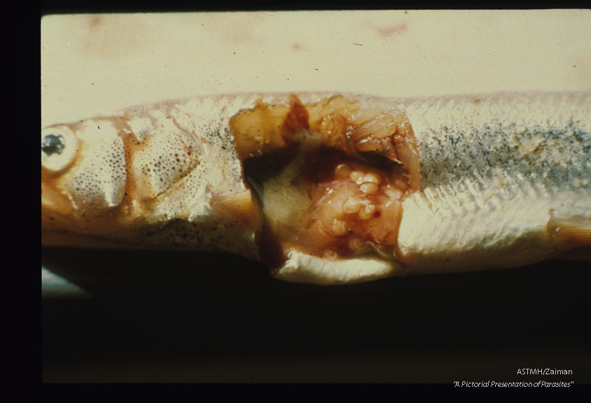 Plerocercoids in a smelt, Osmerus eperlanus.