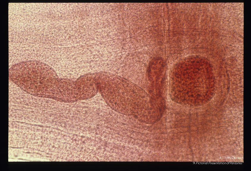 Genital complex. Uterus full of eggs.