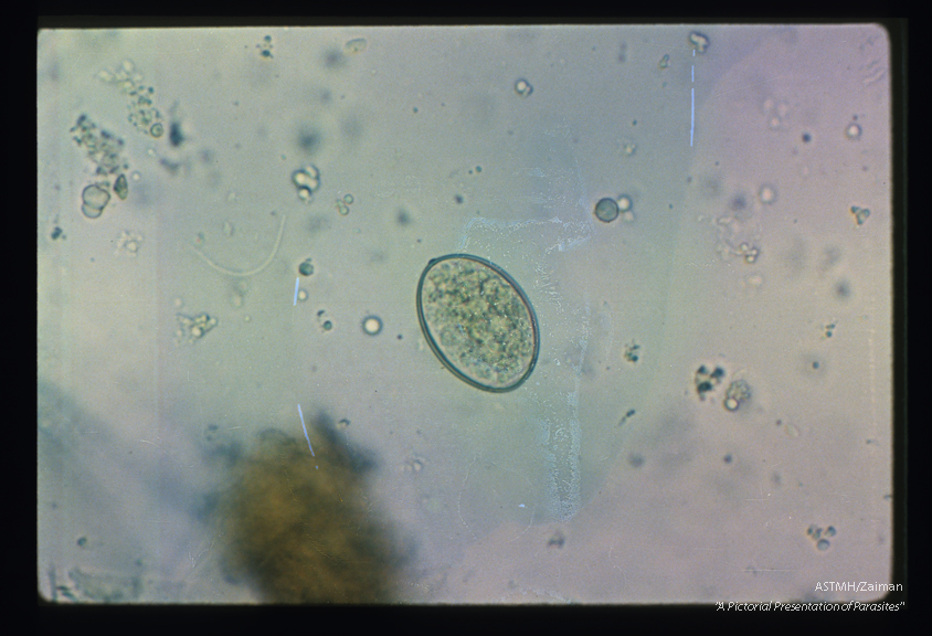 Egg in stool showing the operculum and a knob at the abopercular end.