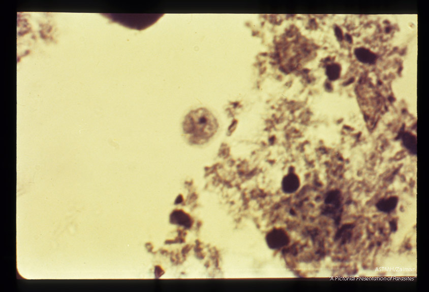 Human appendix, low and high powers. Iron hematoxylin stain.