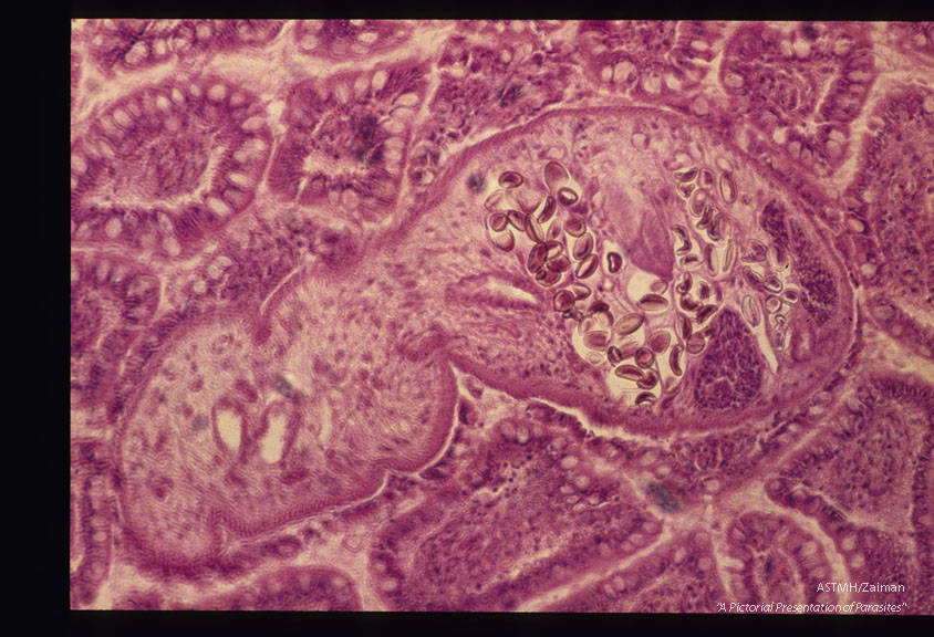 Adult in intestinal wall.