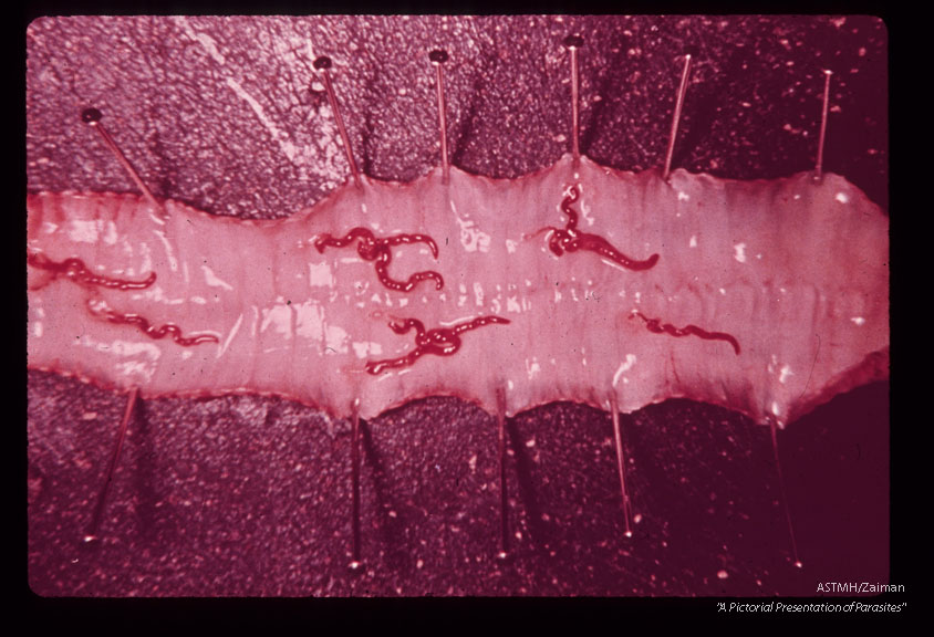 Several pairs are seen in the trachea of a turkey.