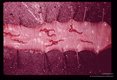 Several pairs are seen in the trachea of a turkey.