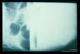Intestinal obstruction due to ascariasis is demonstrated on x-ray by dilatation of the small bowel by gas and fluid. X-rays made in a supine patient (2116) show enlarged gas-filled (black) boweled loops. When films are made with patients in the upright position, gas (black) in the dilated loops, layers above the white fluid (2117). Dilated small bowel with air fluid levels are pathognomonic for small bowel obstruction. In this case, the obstruction was due to A scans.