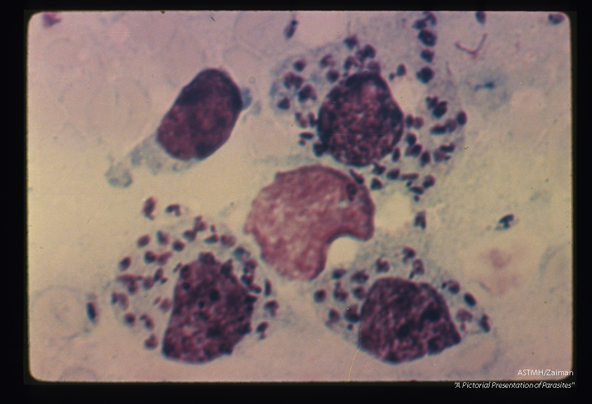 High power view of touch preparation made from experimentally infected hamster. Several parasites are present in each of three macrophages.