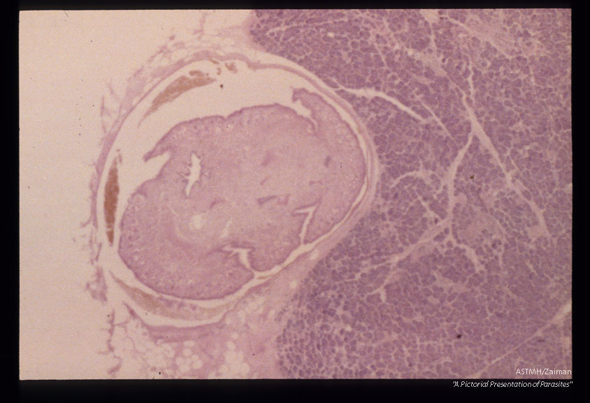 Nymphs in pancreas.