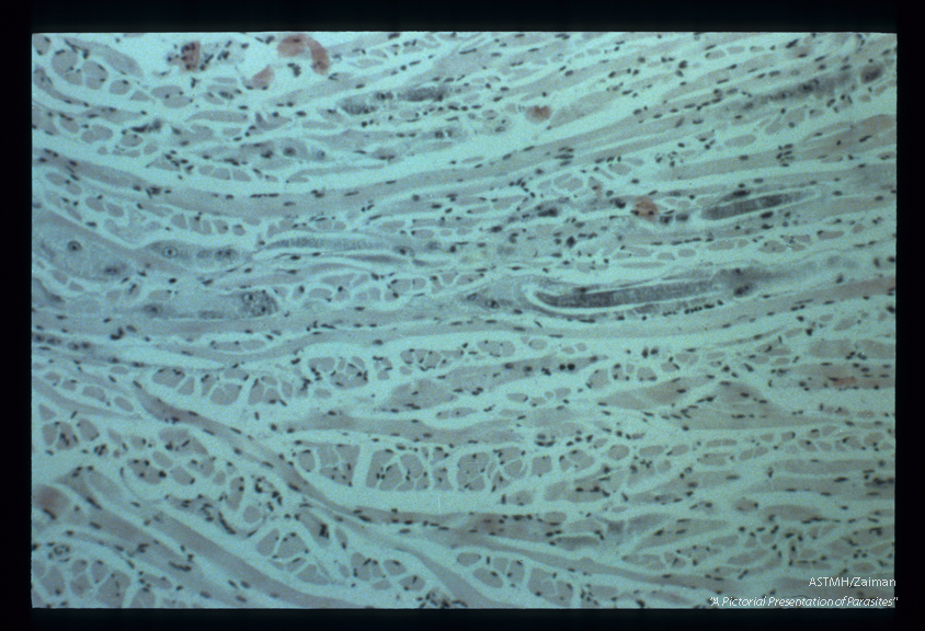 Parts of two very young larvae are seen invading muscle.