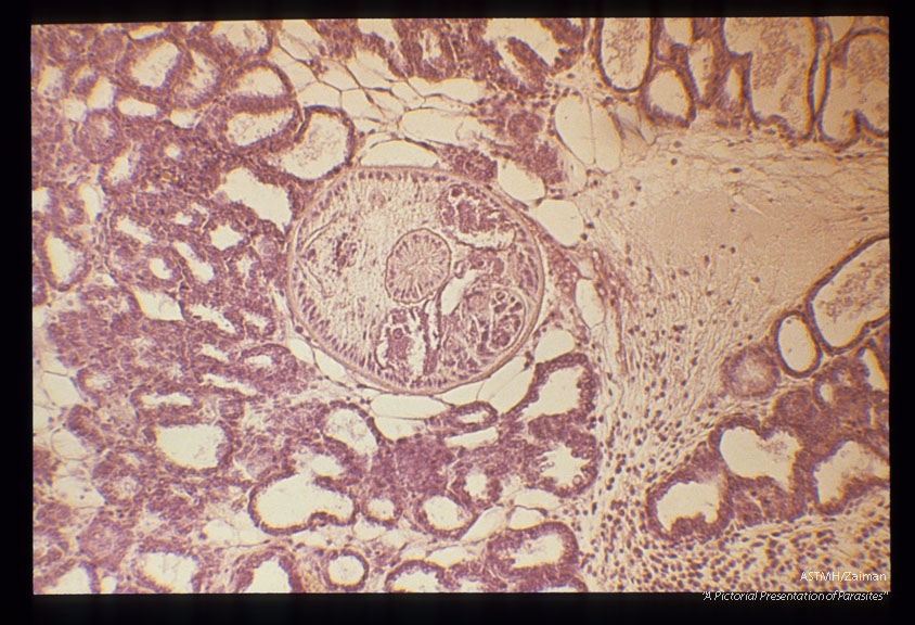 Mesocercarial stage in the adipose tissue of a mouse mammary gland. Note the large, unicellular penetration glands. Low and high magnifications.