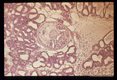 Mesocercarial stage in the adipose tissue of a mouse mammary gland. Note the large, unicellular penetration glands. Low and high magnifications.
