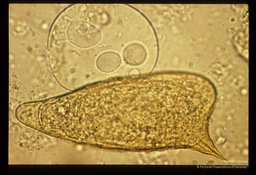 Egg with circumoval precipitate.