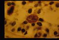 Migrating larva is present in a seminiferous tubule.
