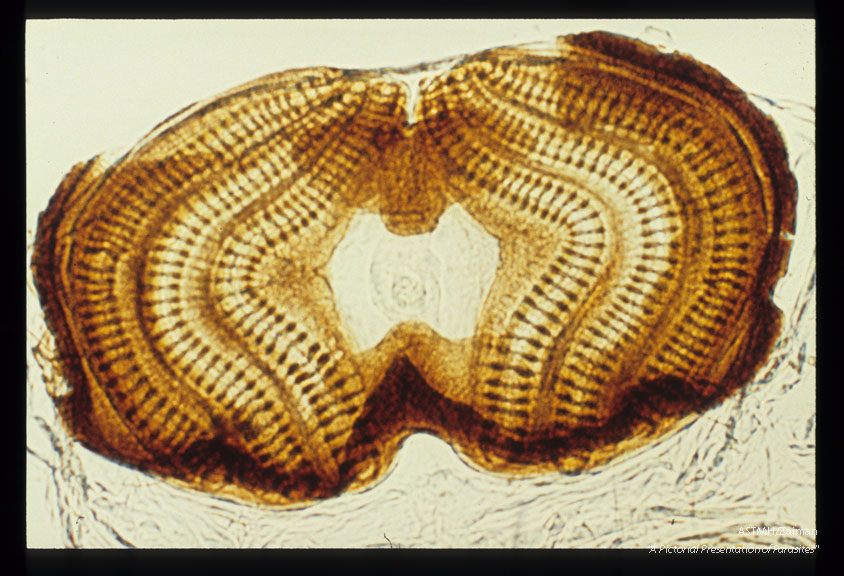 Maggot posterior spiracle.