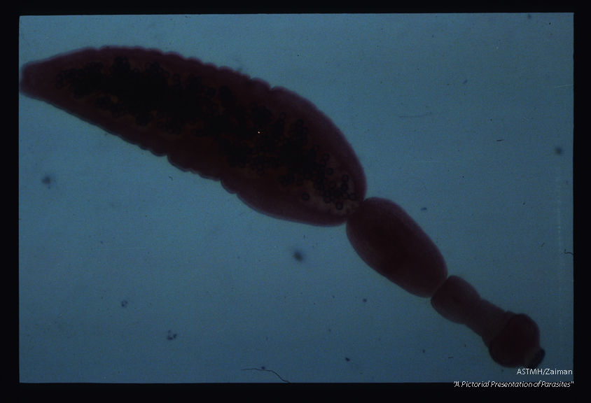 Adult, The hooks on the scolex appear as a dark ring. Numerous eggs are present in the terminal proglottid.