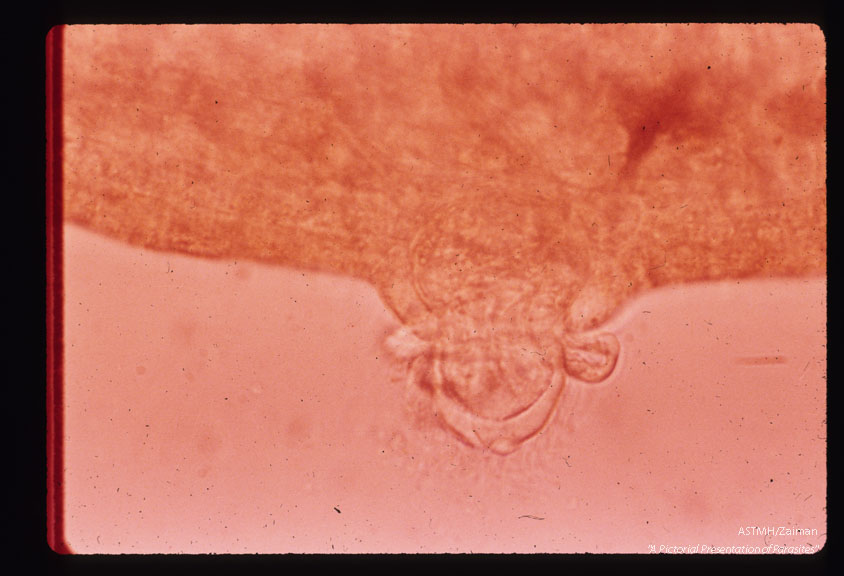 Miracidium penetrating the snail host and shedding the third row of epidermal plates.